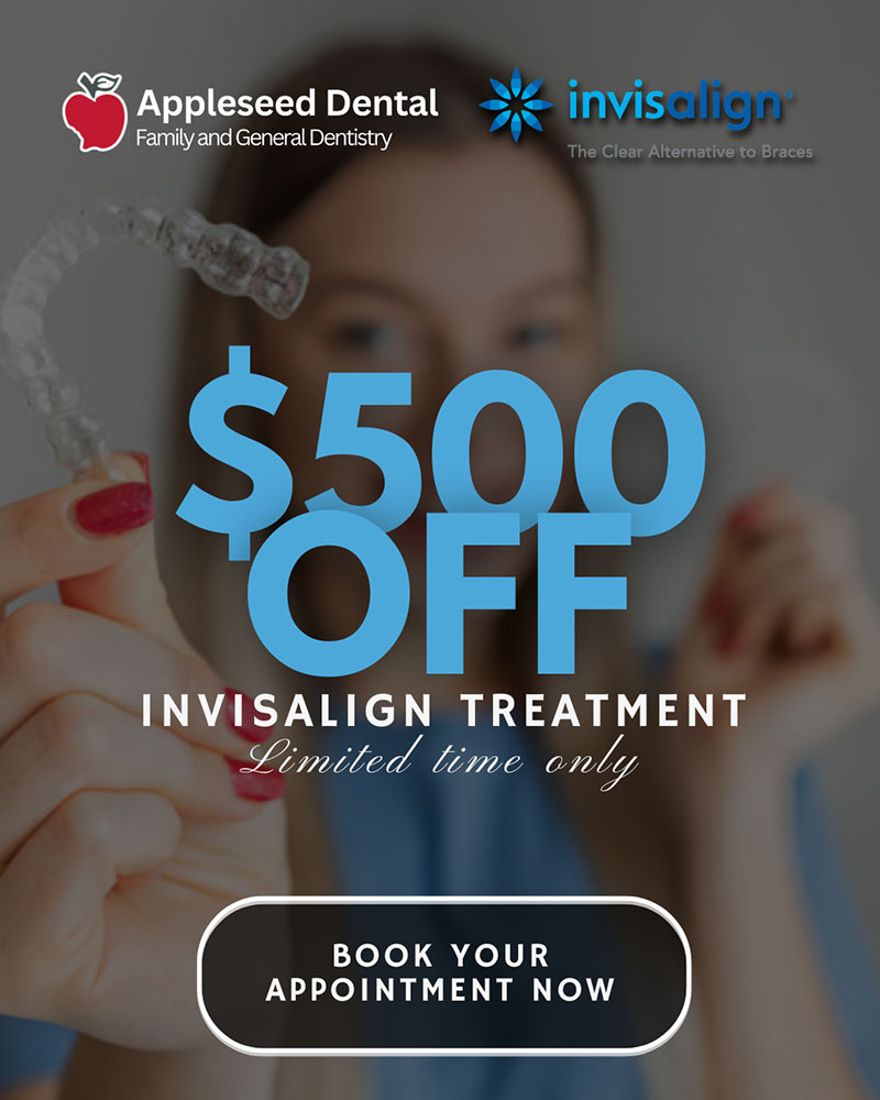 Appleseed Dental | Extractions, Night Guards and Dental Sealants