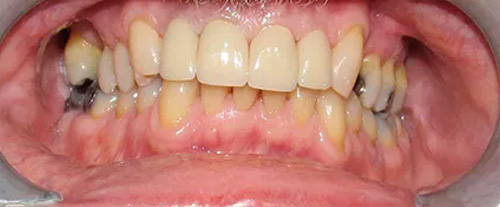 Emergency Dentist Leominster