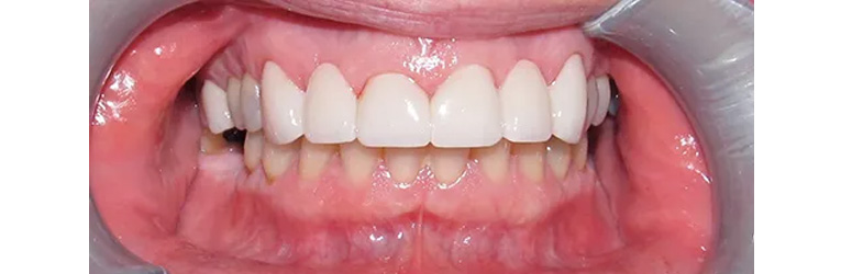 Dentist in Leominster