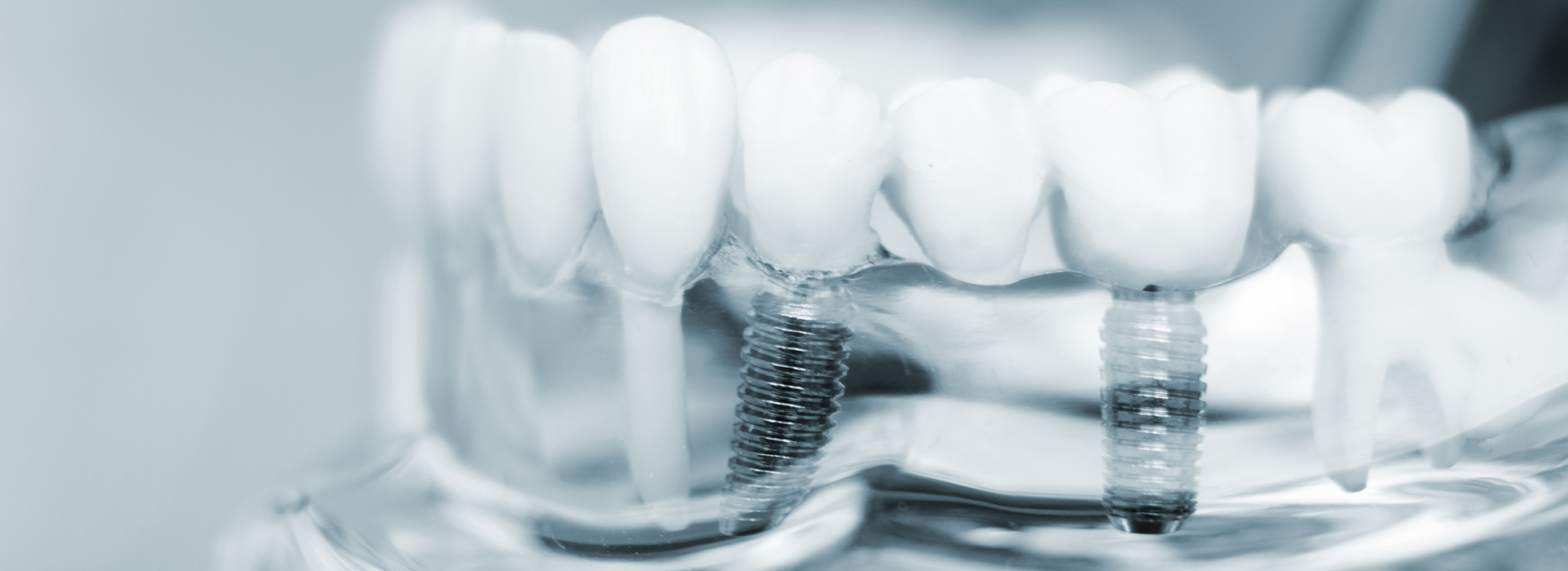 Appleseed Dental | Botox reg , Cosmetic Dentistry and Implant Dentistry